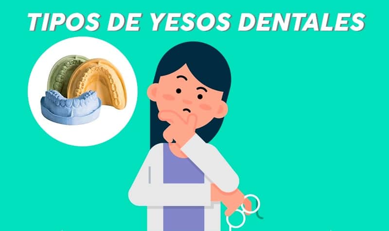 tipos de yesos dentales